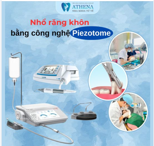 NHỔ RĂNG KHÔN BẰNG CÔNG NGHỆ SÓNG SIÊU M PIEZOTOME