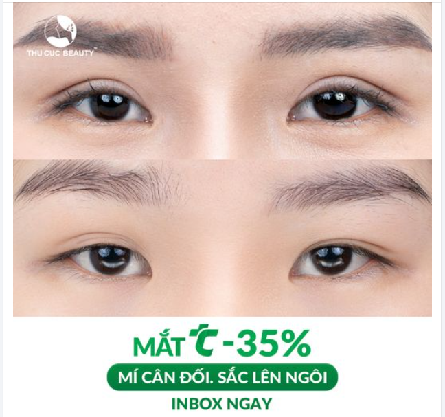 Đôi mắt to tròn, cân đối. Tự tin hơn với diện mạo mới