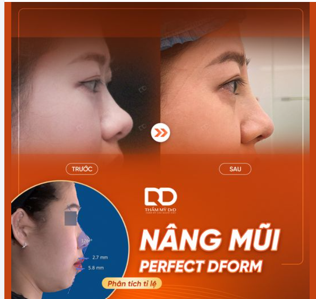 Khoe ngay dáng mũi siêu tự nhiên vừa thực hiện.