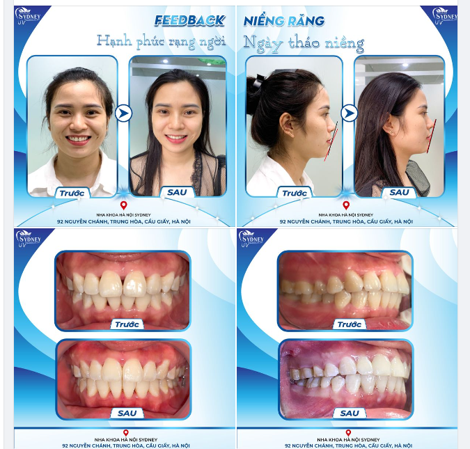 HẠNH PHÚC RẠNG NGỜI NGÀY THÁO NIỀNG