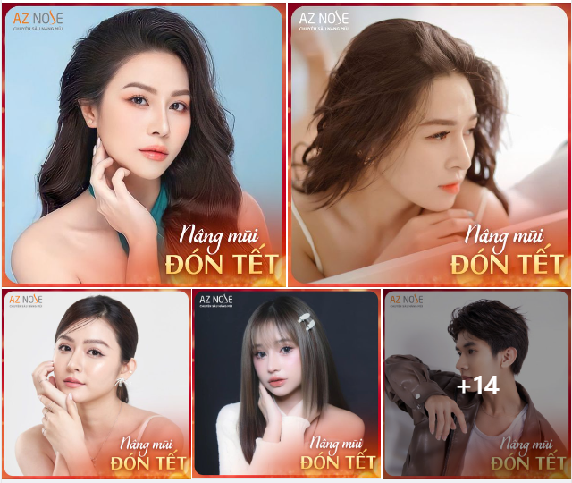 TẠI SAO ĐÂY LÀ THỜI ĐIỂM TỐT NHẤT ĐỂ NÂNG MŨI ĐÓN TẾT?