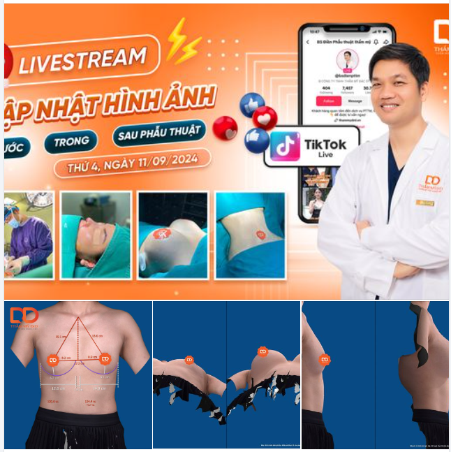 Trời mưa gió nhưng chị em vẫn hào hứng đi làm đẹp.