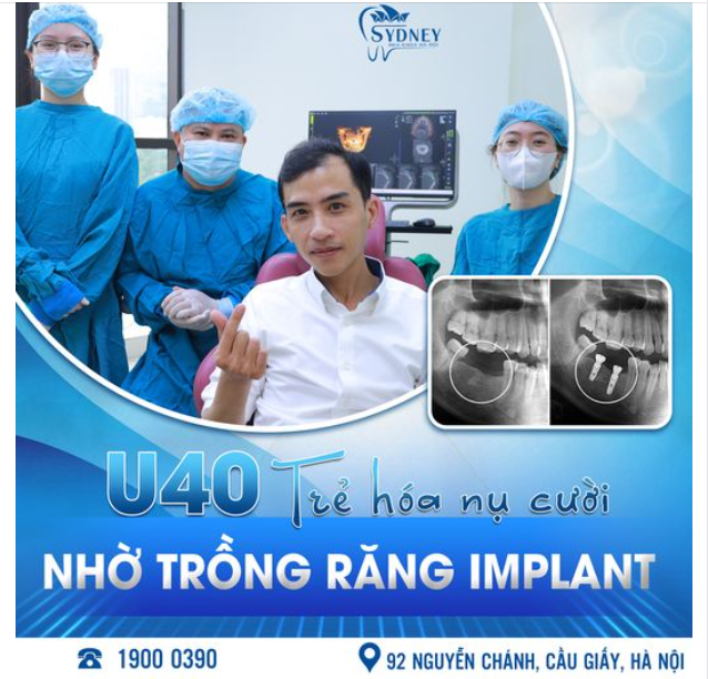 U40 TRẺ HÓA NỤ CƯỜI NHỜ TRỒNG RĂNG IMPLANT