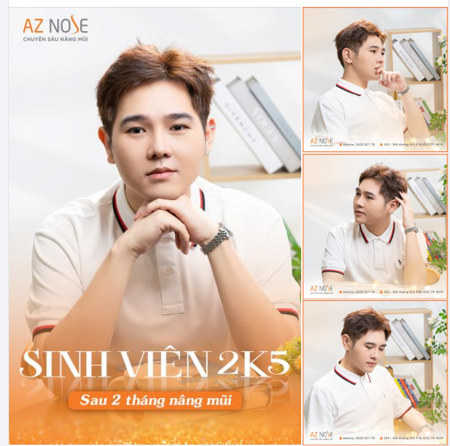 Visual ngời ngời của nam sinh 2K5 sau 2 tháng nâng mũi
