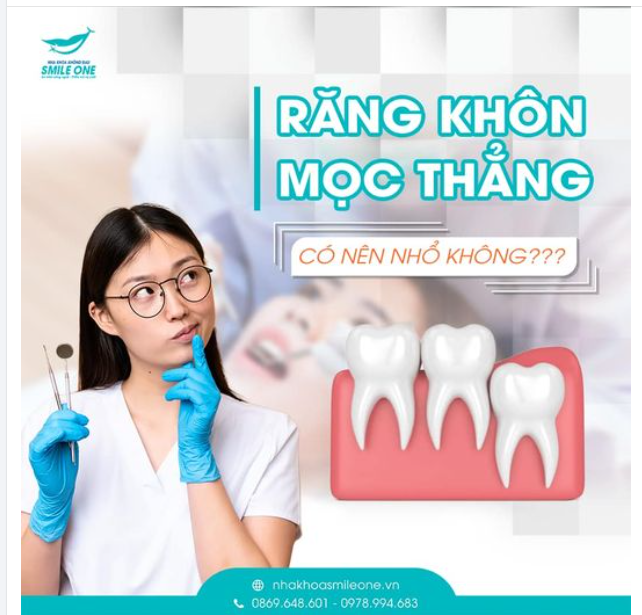 Răng khôn mọc thẳng có cần phải nhổ không