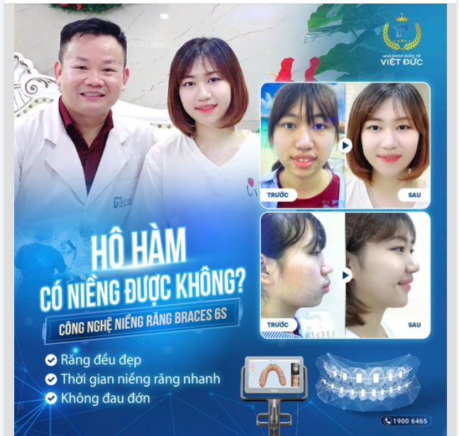 RĂNG HÔ, HÀM HÔ ĐẾN MẤY CŨNG PHẢI CHÀO THUA