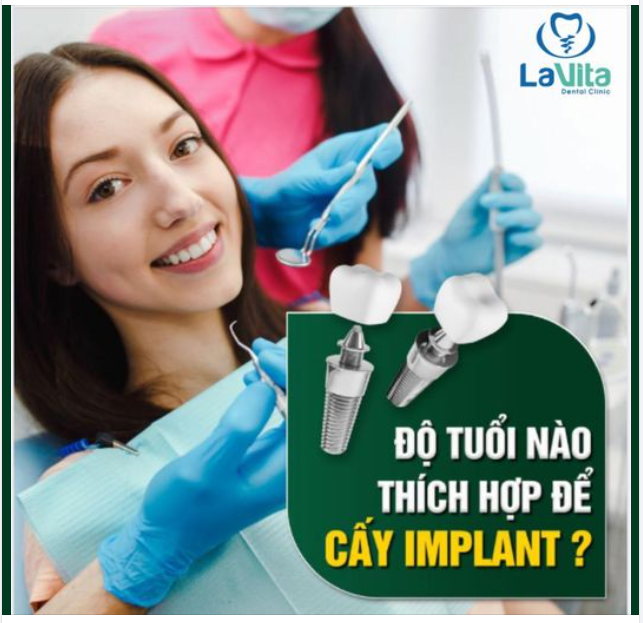 ĐỘ TUỔI THÍCH HỢP ĐỂ CẤY GHÉP IMPLANT