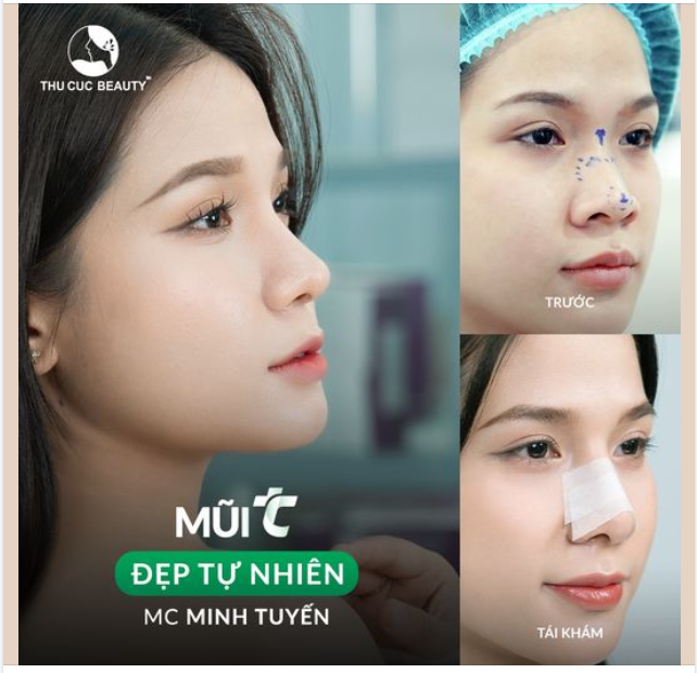 Make up cả năm không bằng 1 lần nâng mũi