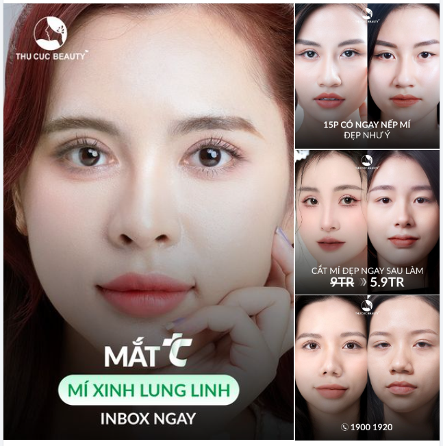 Mắt TC - Khắc phục mọi khuyết điểm như mí hỏng, 1 mí, đa nếp mí, sụp mí,...