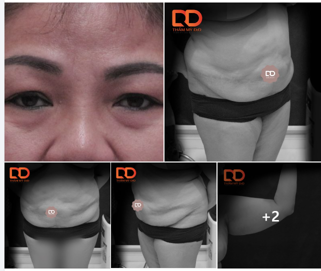 Thứ 3 tại DrD có gì?