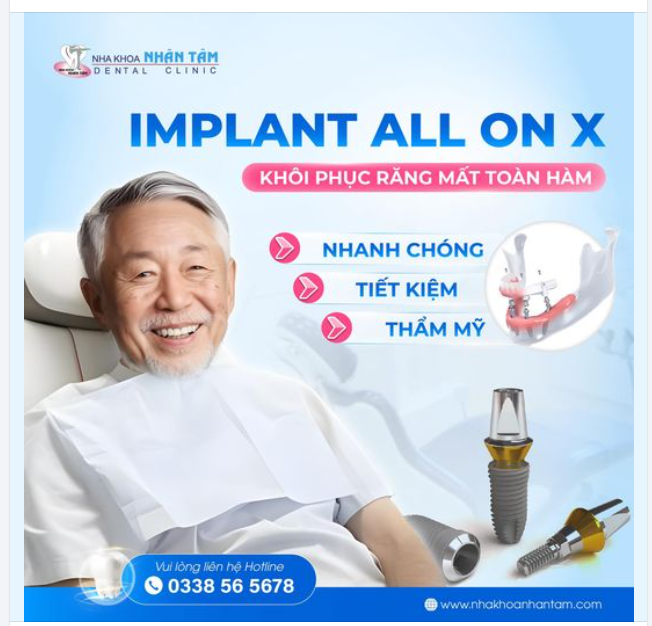 Tự tin cười mỗi ngày với giải pháp Implant All On X