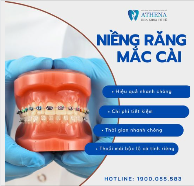 Nếu bạn đang tìm kiếm một giải pháp chỉnh nha hiệu quả mà vẫn đảm bảo tính kinh tế, niềng răng mắc cài truyền thống chính là lựa chọn hàng đầu.