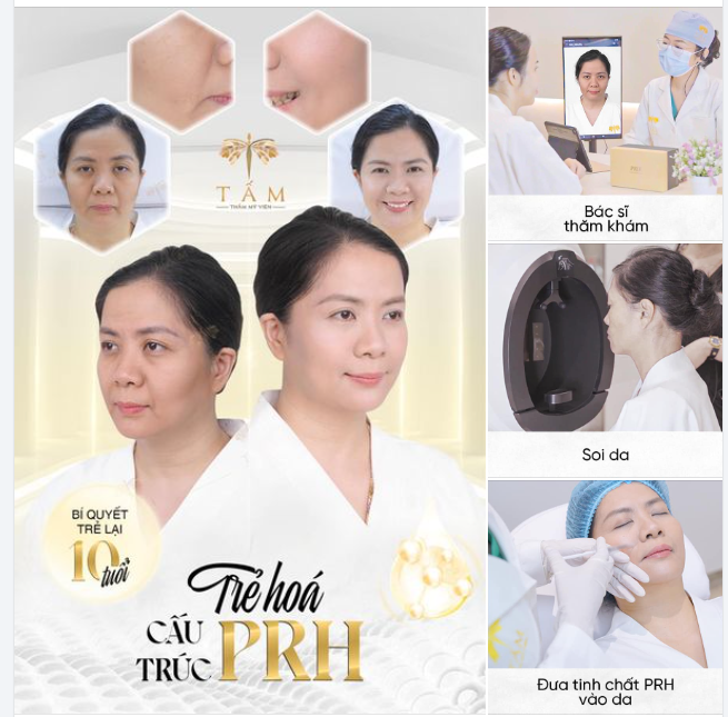 Trẻ hóa PRH phù hợp với những ai?