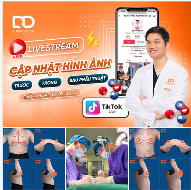 Hình ảnh trước phẫu thuật và mô phỏng kết quả của khách hàng thực hiện phẫu thuật hôm nay