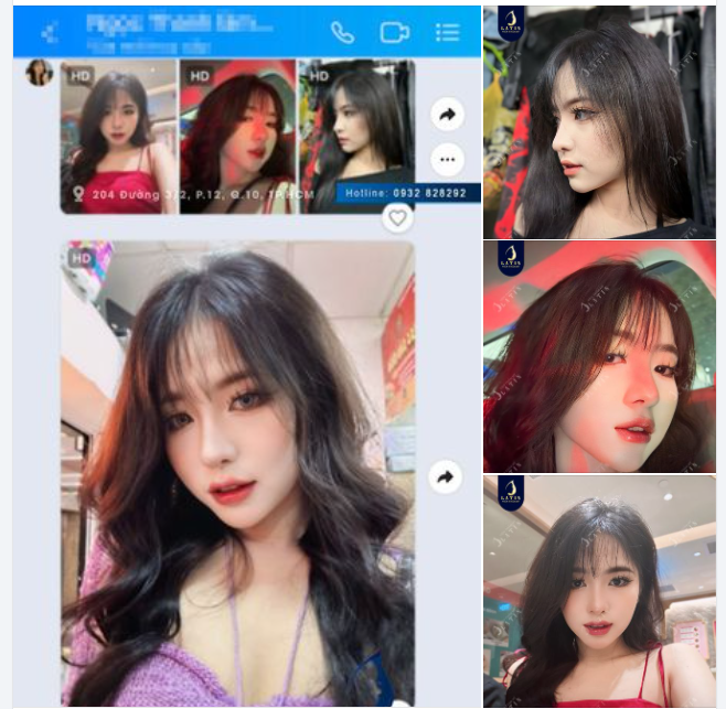 Đi nâng mũi cùng em gái và cái kết "đẹp mọi góc chụp"