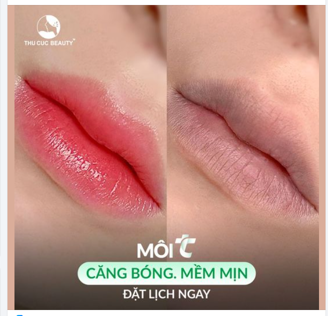 Môi TC - Điểm 10 cho đôi môi căng mọng, sắc hồng tự nhiên