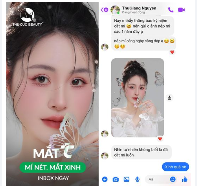 Nếp mí càng ngày càng đẹp sau 1 năm cắt mí của KH Thu Giang ​​​​​​​ Chị em nhìn có mê không ạ?