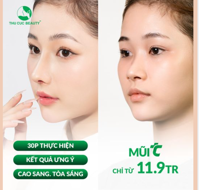 Đến ngay TC Chỉ từ 11.9Tr sở hữu ngay dáng mũi ưng ý