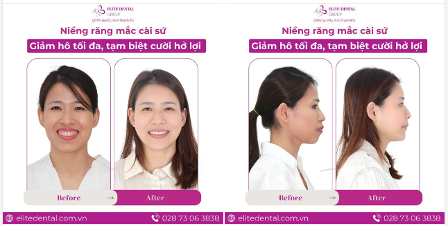 “Học được bao nhiêu là mang ra sử dụng hết vào ca của chị…’’ - Đây là lời bác sĩ chia sẻ với chị Thùy Linh sau khi điều trị.