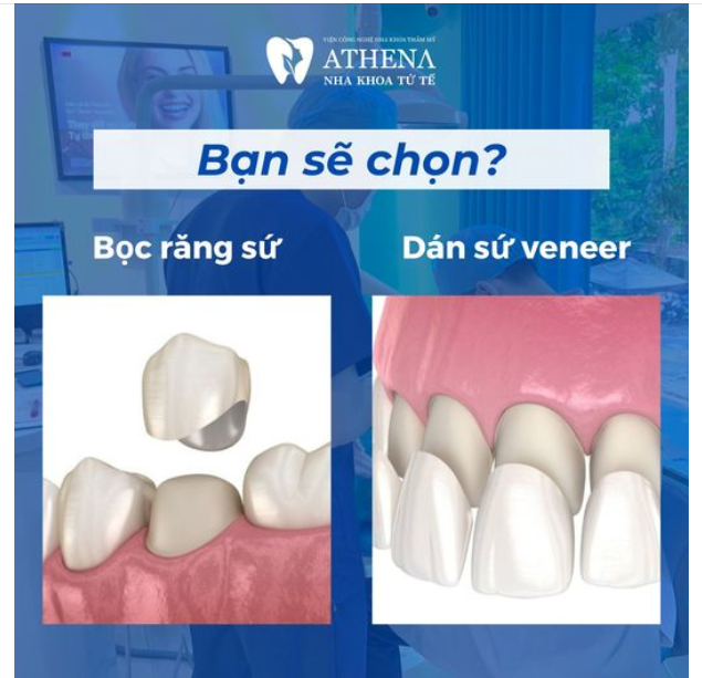 Dán sứ và bọc sứ thẩm mỹ là hai giải pháp phổ biến để cải thiện vẻ đẹp và sự đều đặn của hàm răng.