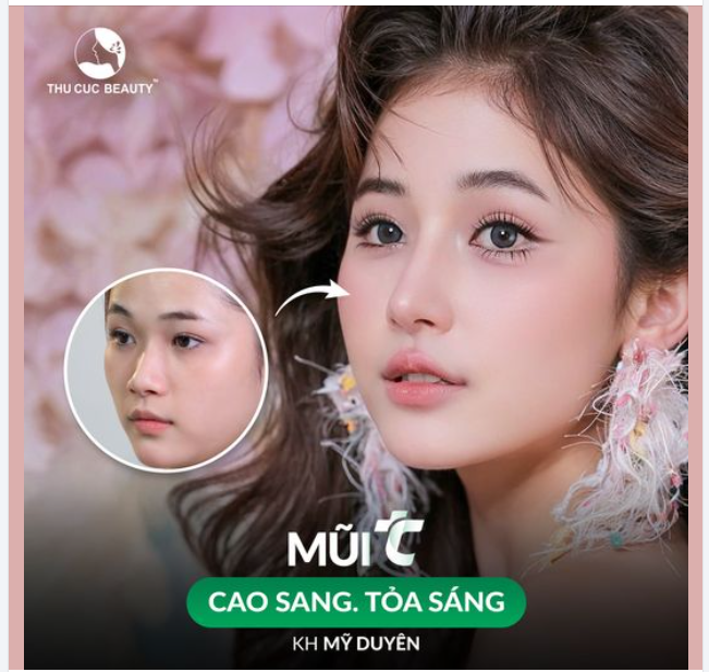 Thêm ngay vào list việc cần phải làm: Nâng mũi tại Thu Cúc vào tháng 9 này.