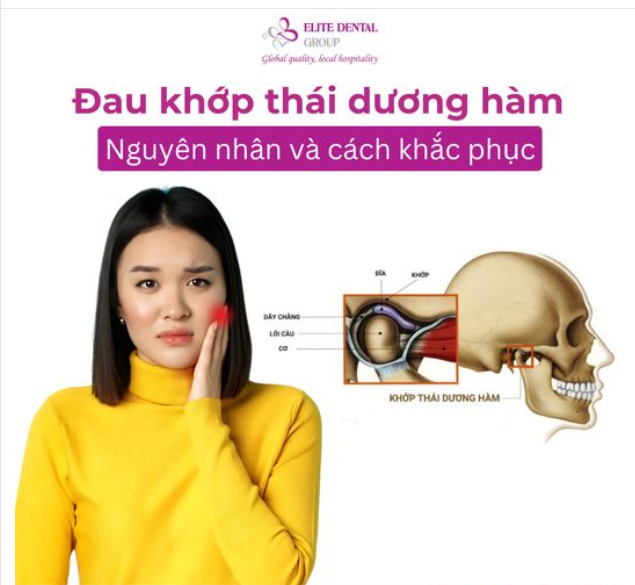 Khớp thái dương hàm là gì và nguyên nhân nào dẫn đến đau khớp hàm?