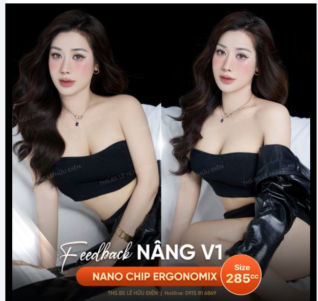 Ở đây không có quảng cáo, ở đây chỉ có feedback Nâng V1 của khách hàng DrD.