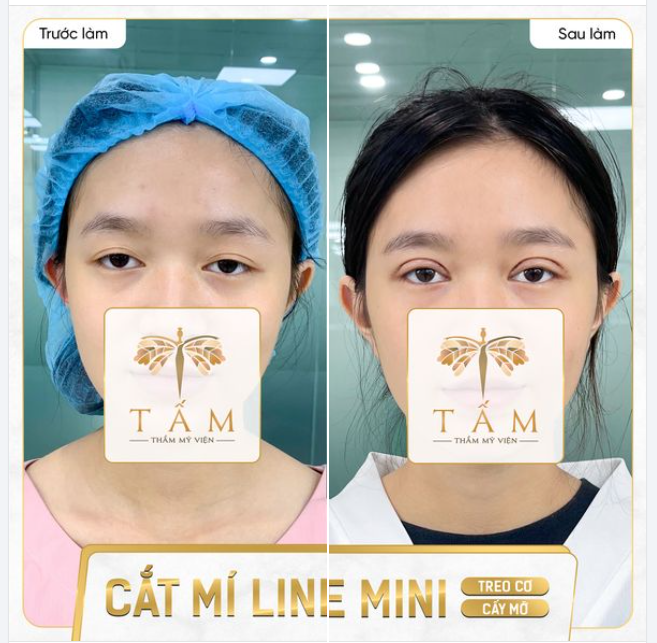 Hình ảnh chân thực của khách hàng sử dụng dịch vụ tại TMV Tấm