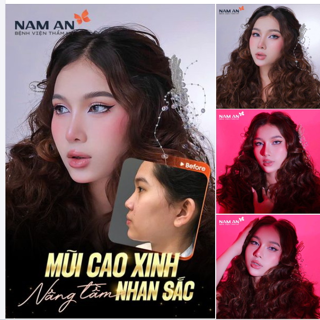 MŨI CAO XINH NÂNG TẦM NHAN SẮC