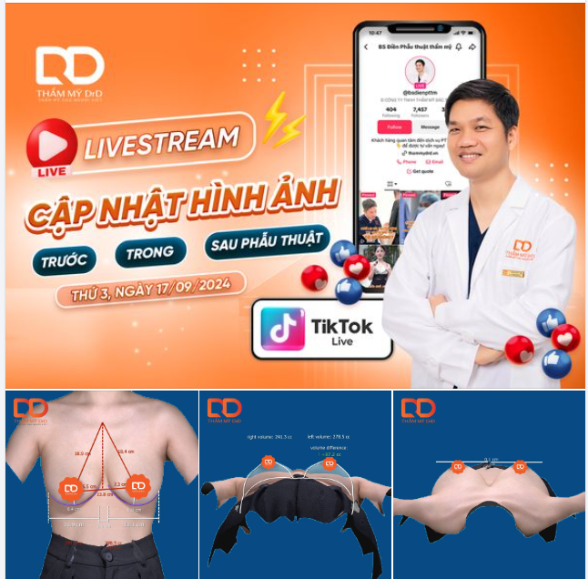 Chị em theo dõi ngay livestream và cùng chờ đợi kết quả của ca mổ ngày hôm nay nhé!