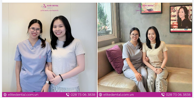 Chúc mừng chị Kim Ngọc đã hoàn tất quá trình niềng răng điều trị răng chen chúc, cắn chéo và lệch hàm cùng Thạc sĩ - bác sĩ Thanh Tùng tại Elite Dental.