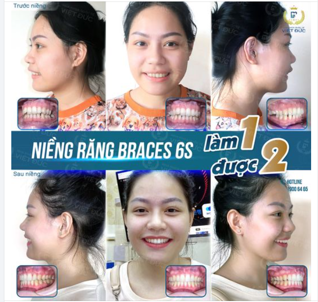 NHỮNG CÁCH ĐỂ CÓ GÓC NGHIÊNG THẦN THÁNH