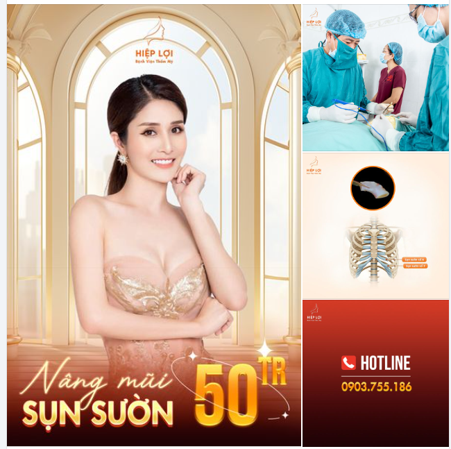 NÂNG MŨI SỤN SƯỜN - Chỉ còn 50 TRIỆU 7 NGÀY ĐẸP TỰ NHIÊN