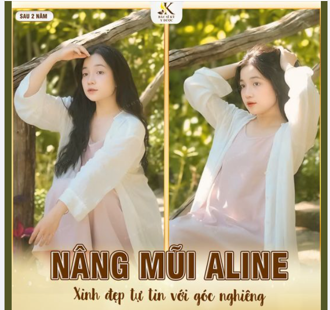 KHÁCH HÀNG “KHOE” NHAN SẮC ĐẸP “HƠN HOA” SAU NÂNG MŨI ALINE