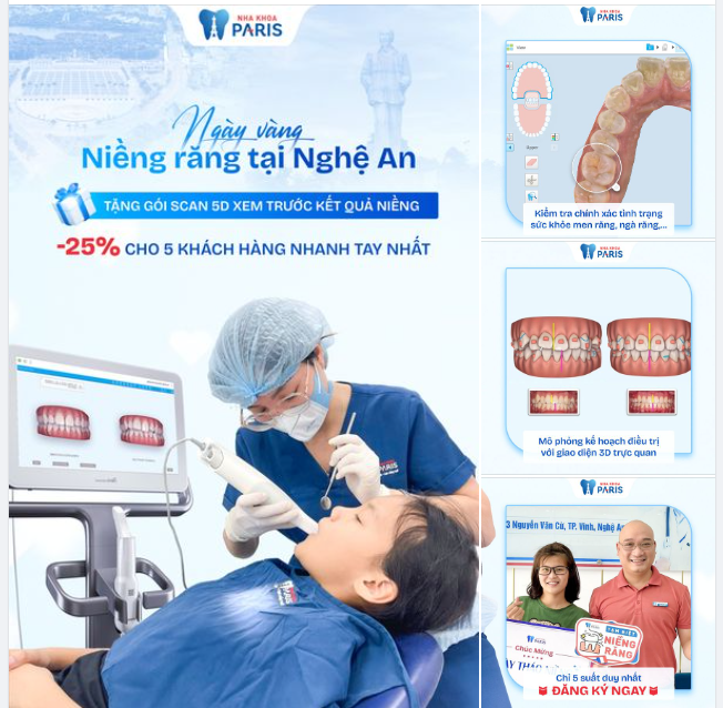 BẠN ĐỪNG QUÊN NGÀY HỘI NIỀNG RĂNG INVISALIGN - TRẢI NGHIỆM SCAN ITERO 5D MIỄN PHÍ