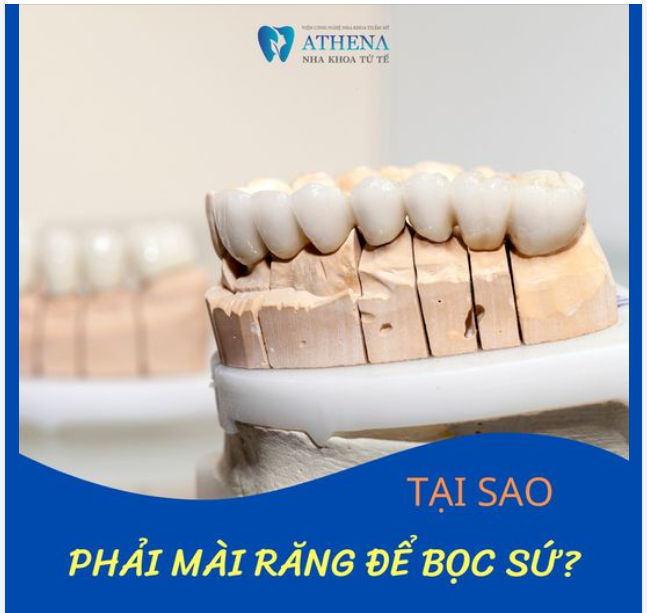 Tại sao phải mài răng khi bọc răng sứ?