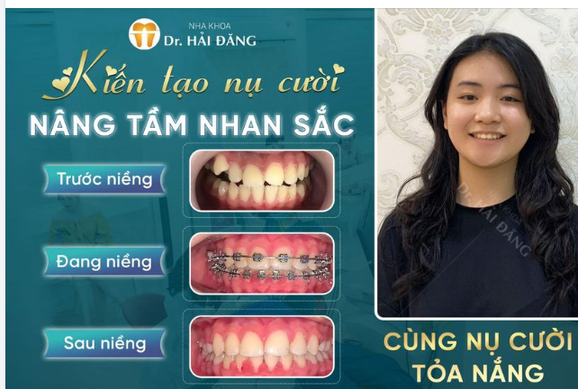 NGÀN LỜI QUẢNG CÁO CŨNG KHÔNG BẰNG MỘT LỜI CẢM NHẬN CỦA KHÁCH HÀNG SAU KHI THÁO NIỀNG