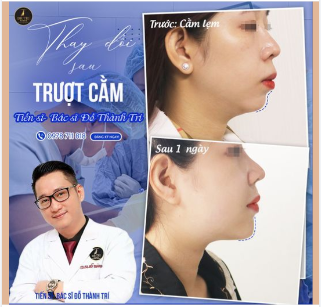 TĂNG ĐỘ NHÔ CẰM ĐỂ KHẮC PHỤC HÔ CHO CÔ GÁI