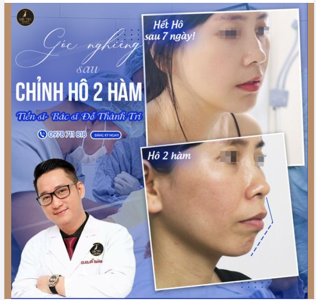 7 NGÀY THAY ĐỔI GÓC NGHIÊNG! 7 NGÀY THAY ĐỔI CUỘC ĐỜI!