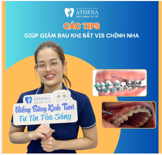 6 Típ giúp làm giảm đau khi bắt vít chỉnh nha