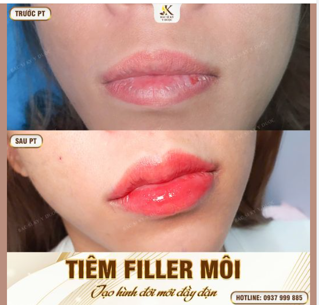Đôi môi này chỉ biết ăn cơm cá. Đã bao giờ được thơm má ai đâu...