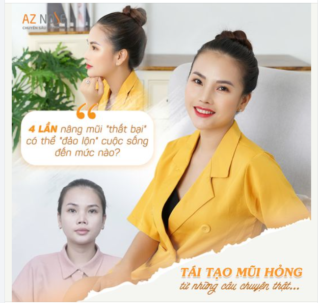4 lần nâng mũi KHÔNG THÀNH CÔNG và những "biến cố" bất ngờ...