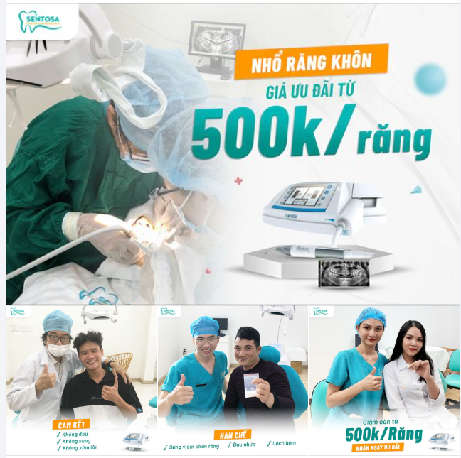 NHỔ RĂNG KHÔN GIÁ ƯU ĐÃI TỪ 500.000Đ/RĂNG