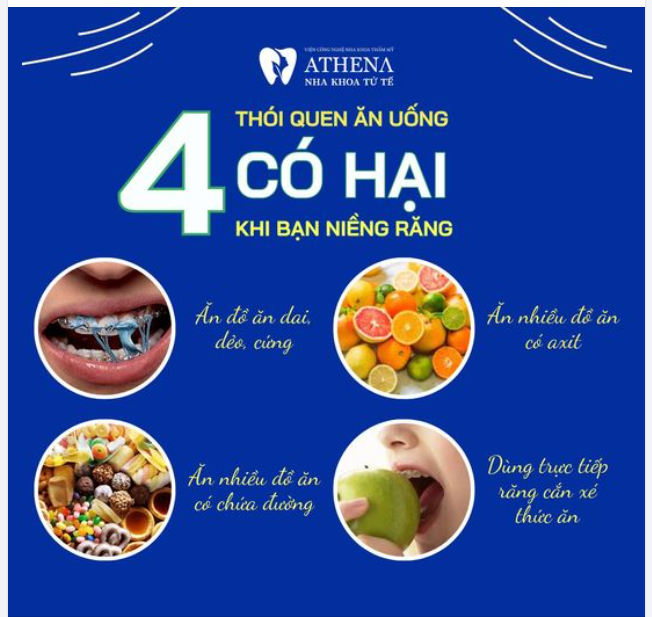 4 thực phẩm cần tránh khi niềng răng để đảm bảo kết quả tốt nhất