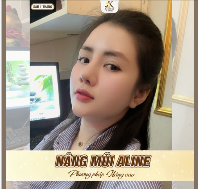 CHUYÊN MỤC FEEDBACK MŨI XINH