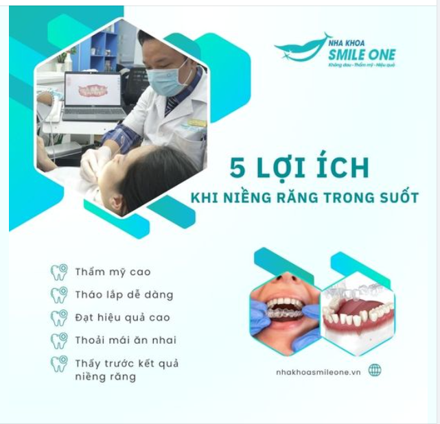 5 LỢI ÍCH KHI NIỀNG RĂNG TRONG SUỐT BẠN NÊN BIẾT!