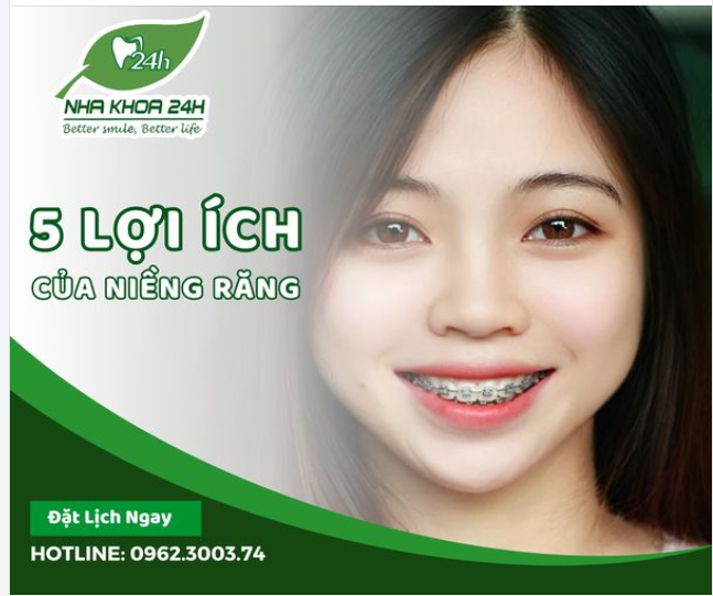LỢI ÍCH KHI NIỀNG RĂNG?