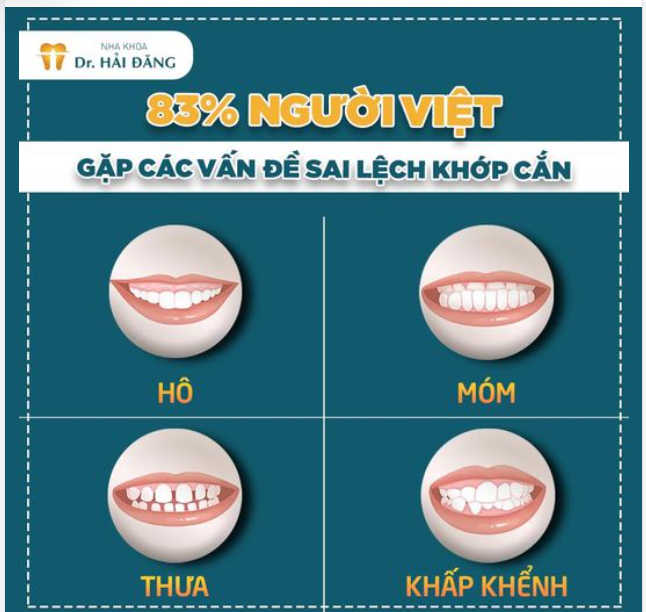 Hiện nay có 2 phương pháp phổ biến để khắc phục khuyết điềm răng miệng đó chính là niềng răng và bọc sứ thẩm mỹ.