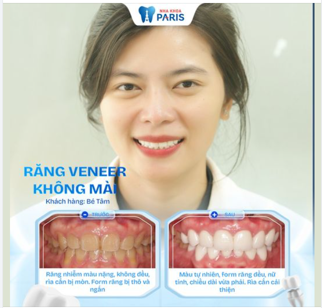 Kh. Bé Tâm đến với Hệ thống Nha khoa Paris - Bệnh viện RHM Paris trong tình trạng: