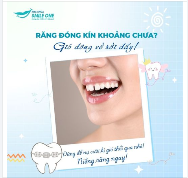 GIÓ ĐÔNG VỀ RỒI ĐẤY, RĂNG ĐÃ ĐÓNG KÍN KHOẢNG CHƯA???